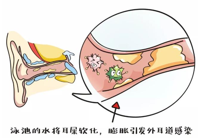 游泳耳朵防水技巧_游泳防耳朵进水的装备_防水游泳耳朵技巧视频